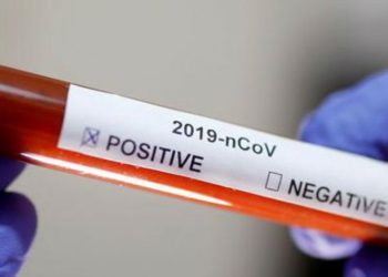 Abinader demanda masificar pruebas gratis del Coronavirus