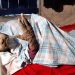 Hombre padece extraña enfermedad de piel clama por ayuda médica